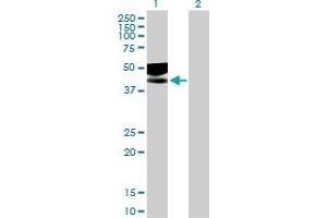 Western Blot analysis of IL1R2 expression in transfected 293T cell line by IL1R2 MaxPab polyclonal antibody. (IL1R2 抗体  (AA 1-398))