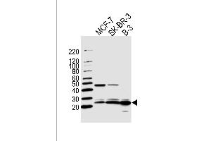 Western blot analysis of lysates from MCF-7, SK-BR-3, B-3 cell line (from left to right), using C13orf30 Antibody (C-term) (ABIN1944729 and ABIN2838567). (C13orf30 抗体  (C-Term))