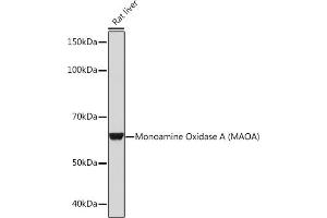 Western blot analysis of extracts of Rat liver, using Monoamine Oxidase A (MAOA) (MAOA) Rabbit mAb (ABIN1682632, ABIN3018542, ABIN3018543 and ABIN7101625) at 1:1000 dilution. (Monoamine Oxidase A 抗体)