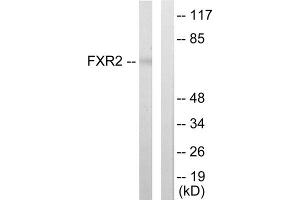 Western blot analysis of extracts from COLO205 cells, using FXR2 antibody.