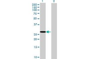 Western Blot analysis of TSSK6 expression in transfected 293T cell line by TSSK6 MaxPab polyclonal antibody. (TSSK6 抗体  (AA 1-273))