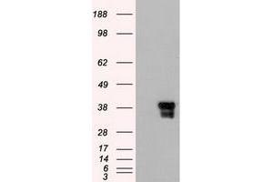 HEK293T cells were transfected with the pCMV6-ENTRY control (Left lane) or pCMV6-ENTRY DFFA (RC202879) (Right lane) cDNA for 48 hrs and lysed.