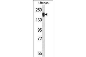 Western blot analysis in human normal Uterus tissue lysates (35ug/lane). (USP43 抗体  (C-Term))