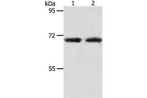 Western Blot analysis of Human liver cancer and fetal kidney tissue using ACOT11 Polyclonal Antibody at dilution of 1:650 (ACOT11 抗体)
