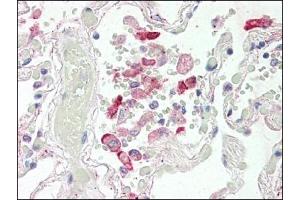 Image no. 1 for anti-Carboxylesterase 1 (CES1) (Internal Region) antibody (ABIN372769) (CES1 抗体  (Internal Region))