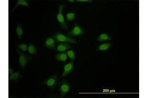 Immunofluorescence of monoclonal antibody to HNF4A on HeLa cell. (HNF4A 抗体  (AA 324-423))