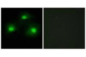 Immunofluorescence analysis of HeLa cells, using TPD52 antibody. (PKIA 抗体)