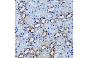 Immunohistochemistry (Paraffin-embedded Sections) (IHC (p)) image for anti-Inositol(myo)-1(or 4)-Monophosphatase 1 (IMPA1) (AA 1-277) antibody (ABIN6142429)