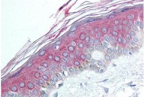 Human Skin (formalin-fixed, paraffin-embedded) stained with HDAC4 antibody ABIN292441 at 1:50 followed by biotinylated goat anti-rabbit IgG secondary antibody ABIN481713, alkaline phosphatase-streptavidin and chromogen. (HDAC4 抗体  (N-Term))