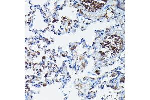 Immunohistochemistry of paraffin-embedded rat lung using G Rabbit pAb (ABIN6129931, ABIN6137010, ABIN6137011 and ABIN6217659) at dilution of 1:100 (40x lens). (APOBEC3G 抗体  (AA 60-330))