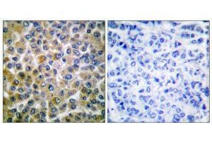 Immunohistochemistry (IHC) image for anti-SMAD, Mothers Against DPP Homolog 1 (SMAD1) (Ser465) antibody (ABIN1847896) (SMAD1 抗体  (Ser465))