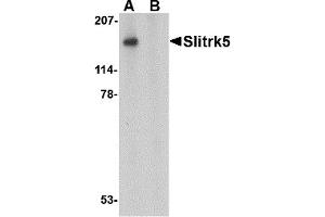Western Blotting (WB) image for anti-SLIT and NTRK-Like Family, Member 5 (SLITRK5) (Middle Region 1) antibody (ABIN1031190) (SLITRK5 抗体  (Middle Region 1))