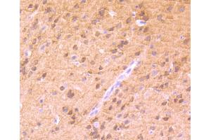 Paraformaldehyde-fixed, paraffin embedded mouse brain tissue, Antigen retrieval by boiling in sodium citrate buffer (pH6) for 15min, Block endogenous peroxidase by 3% hydrogen peroxide for 30 minutes, Blocking buffer (normal serum) at 37°C for 20min, Antibody incubation with PKC alpha(T638) (4B3) Monoclonal Antibody  at 1:50 overnight at 4°C, followed by a conjugated secondary and DAB staining. (PKC alpha 抗体  (pThr638))