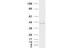 Western Blotting (WB) image for Acetyl-CoA Acyltransferase 2 (ACAA2) protein (Myc-DYKDDDDK Tag) (ABIN2714296)