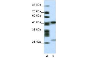 PHF11 antibody used at 0. (PHF11 抗体  (Middle Region))