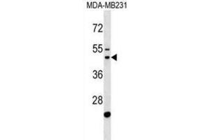 Western Blotting (WB) image for anti-GATS Protein-Like 1 (GATSL1) antibody (ABIN3000715) (GATSL1 抗体)