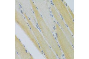 Immunohistochemistry of paraffin-embedded mouse skeletal muscle using CXCR3 Antibody (ABIN5971514) at dilution of 1/100 (40x lens). (CXCR3 抗体)