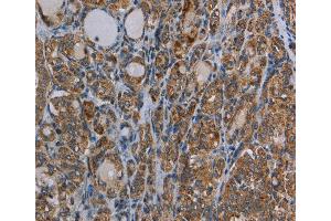 Immunohistochemistry of Human brain  using MYO7A Polyclonal Antibody at dilution of 1:30 (Myosin VIIA 抗体)