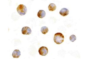 Immunohistochemistry (IHC) image for anti-Induced Myeloid Leukemia Cell Differentiation Protein Mcl-1 (MCL1) (N-Term) antibody (ABIN1031455) (MCL-1 抗体  (N-Term))