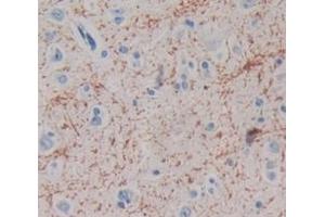 Used in DAB staining on fromalin fixed paraffin- embedded Kidney tissue (MAG 抗体  (AA 328-514))