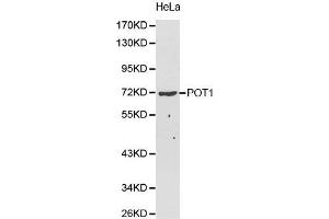 Western Blotting (WB) image for anti-Protection of Telomeres 1 (POT1) (AA 497-634) antibody (ABIN6218570) (POT1 抗体  (AA 497-634))