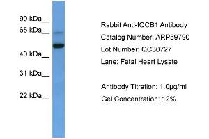 WB Suggested Anti-IQCB1  Antibody Titration: 0. (IQCB1 抗体  (C-Term))