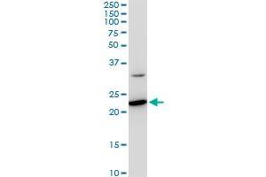 SEC22B monoclonal antibody (M03), clone 5A10. (SEC22B 抗体  (AA 1-110))