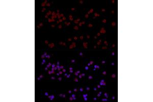 Immunofluorescence (IF) image for anti-B-Cell CLL/lymphoma 11B (Zinc Finger Protein) (BCL11B) antibody (ABIN7265808)