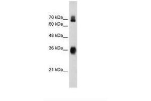 Image no. 2 for anti-Kelch-Like ECH-Associated Protein 1 (KEAP1) (AA 543-592) antibody (ABIN203292) (KEAP1 抗体  (AA 543-592))