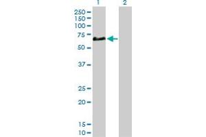 Western Blot analysis of CFHR5 expression in transfected 293T cell line by CFHR5 MaxPab polyclonal antibody. (CFHR5 抗体  (AA 1-569))