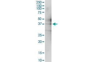 Immunoprecipitation of OBFC1 transfected lysate using anti-OBFC1 MaxPab rabbit polyclonal antibody and Protein A Magnetic Bead , and immunoblotted with OBFC1 purified MaxPab mouse polyclonal antibody (B01P) . (OBFC1 抗体  (AA 1-368))