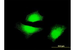 Immunofluorescence of monoclonal antibody to MAP2K5 on HeLa cell. (MAP2K5 抗体  (AA 1-120))