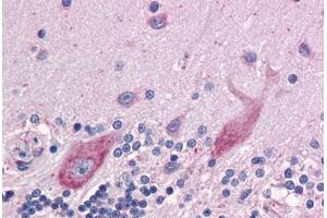 Human Brain, cerebellum: Formalin-Fixed, Paraffin-Embedded (FFPE) (DPF2 抗体  (AA 56-155))