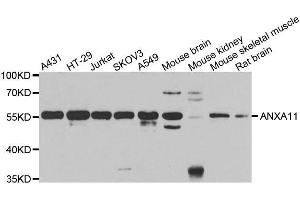 Western blot analysis of extracts of various cell lines, using ANXA11 antibody. (Annexin A11 抗体  (AA 276-505))
