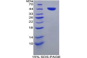SDS-PAGE analysis of Pig Tryptase Protein. (TPSAB1 蛋白)