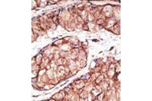 Image no. 2 for anti-Toll-Like Receptor 5 (TLR5) (N-Term) antibody (ABIN357051) (TLR5 抗体  (N-Term))