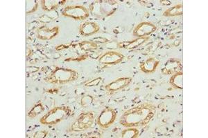 Immunohistochemistry (IHC) image for anti-NADH Dehydrogenase (Ubiquinone) Fe-S Protein 1, 75kDa (NADH-Coenzyme Q Reductase) (NDUFS1) (AA 80-290) antibody (ABIN7160986)