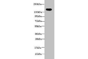 Western Blotting (WB) image for anti-ADAM Metallopeptidase with Thrombospondin Type 1 Motif, 7 (ADAMTS7) (AA 242-593) antibody (ABIN7142894)