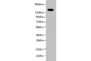 Western blot All lanes: ADAMTS7 antibody at 2 μg/mL + Mouse brain tissue Secondary Goat polyclonal to rabbit IgG at 1/10000 dilution Predicted band size: 184 kDa Observed band size: 184 kDa (ADAMTS7 抗体  (AA 242-593))