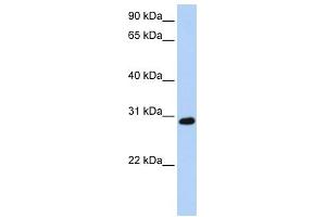 WB Suggested Anti-XBP1 Antibody Titration: 0. (XBP1 抗体  (C-Term))