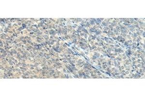 Immunohistochemistry (Paraffin-embedded Sections) (IHC (p)) image for anti-CTD (Carboxy-terminal Domain, RNA Polymerase II, Polypeptide A) Phosphatase, Subunit 1 (CTDP1) antibody (ABIN7244948)