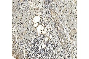 IHC analysis of Aldolase/ALDOA using anti-Aldolase/ALDOA antibody (ABIN7601908). (ALDOA 抗体  (AA 50-364))