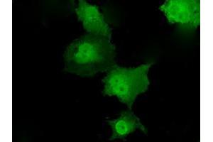 Anti-TKT mouse monoclonal antibody (ABIN2453725) immunofluorescent staining of COS7 cells transiently transfected by pCMV6-ENTRY TKT (RC203497). (TKT 抗体)