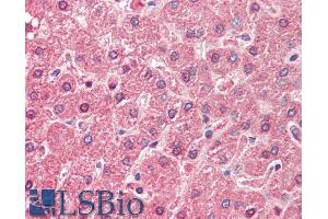 ABIN571255 (5µg/ml) staining of paraffin embedded Human Liver. (ALDH6A1 抗体  (AA 262-272))