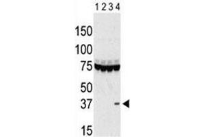 Western blot testing of Aurora-C antibody and lysate of 293 cells expressing 1) Flag tag, 2) Flag-tagged -A, 3) -B and 4) Aurora-C. (Aurora Kinase C 抗体  (AA 115-145))