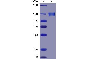 SDS-PAGE (SDS) image for Angiotensin I Converting Enzyme 2 (ACE2) (AA 18-740) protein (mFc Tag) (ABIN6961130)