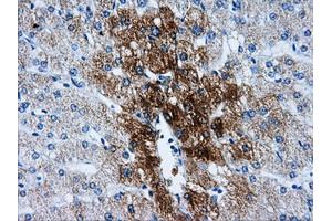 Immunohistochemical staining of paraffin-embedded liver tissue using anti-HSD17B10mouse monoclonal antibody.