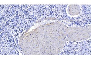 Detection of ELN in Human Spleen Tissue using Polyclonal Antibody to Elastin (ELN) (Elastin 抗体  (AA 392-645))