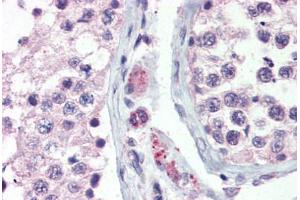 Anti-GPR98 antibody  ABIN1048902 IHC staining of human testis. (ADGRV1 / GPR98 抗体  (N-Term))