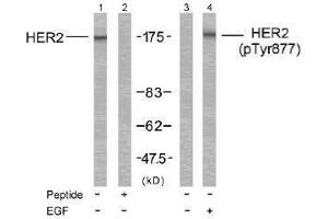 Image no. 2 for anti-Receptor tyrosine-protein kinase erbB-2 (ErbB2/Her2) (Tyr877) antibody (ABIN197222) (ErbB2/Her2 抗体  (Tyr877))
